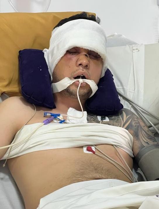 654aad3b-687e-4c9a-9312-f74abd219f5f golpeado