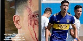 boca