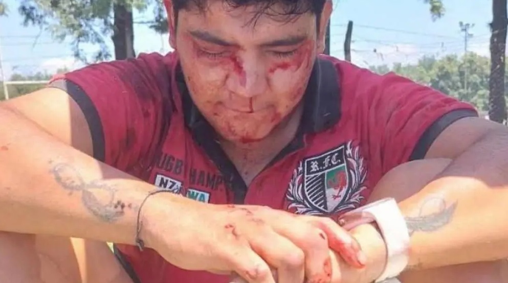 648a0c36-ce20-44d0-82a2-bc0e38373198 crimen