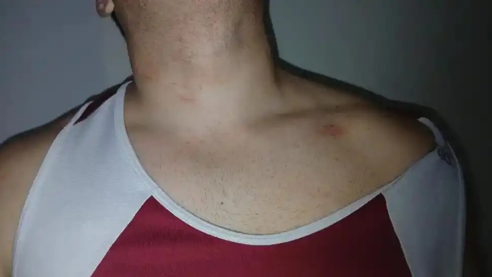 6692ebf5-7056-4eec-be15-5a90c0bdbd32 crimen