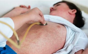 Un caso de sarampión en Entre Ríos reactivó la alerta sanitaria nacional sarampion