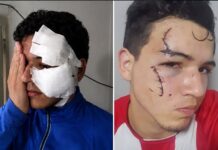 Un joven fue herido por dos delincuentes con tobilleras electrónicas en Tafí Viejo robo