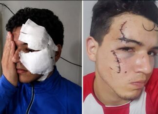 Un joven fue herido por dos delincuentes con tobilleras electrónicas en Tafí Viejo robo