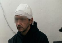 Yerba Buena: golpearon salvajemente a un adolescente de 14 años golpes