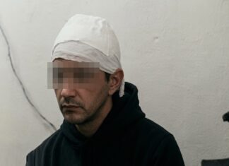 Yerba Buena: golpearon salvajemente a un adolescente de 14 años golpes