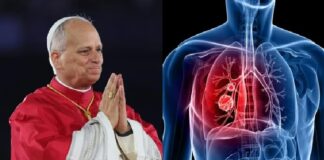 León XIV será internado mañana para su operación por un nódulo pulmonar papa